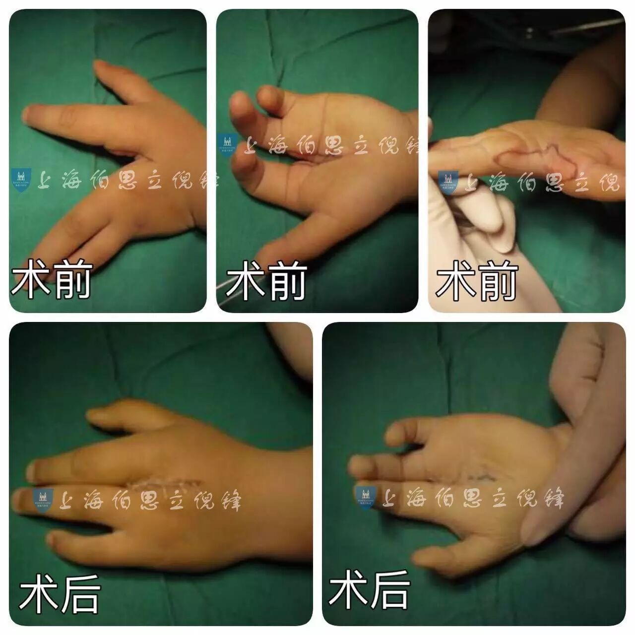 揭秘美国恐怖故事畸形秀龙虾手