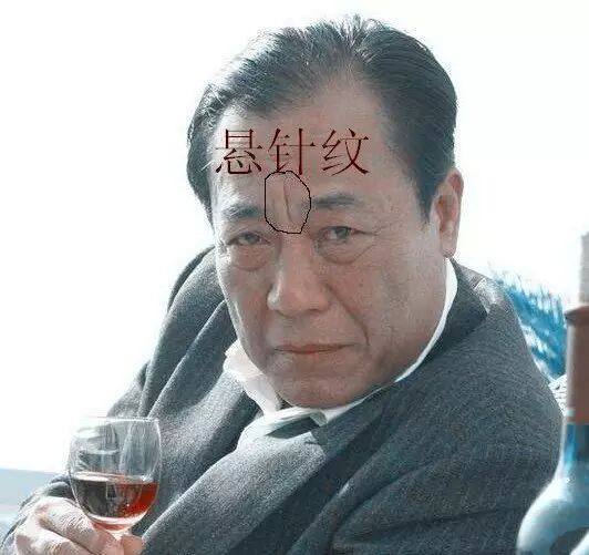 印堂悬针纹粗显,刑夫斩子灾必见;悬针靠上克父母,悬针左斜先送父;悬针