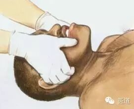 心电监护怎么看图【PLUS版】心电图危急值识别及紧急处理，值得每个医生收藏！！！_https://www.jmylbn.com_新闻资讯_第33张