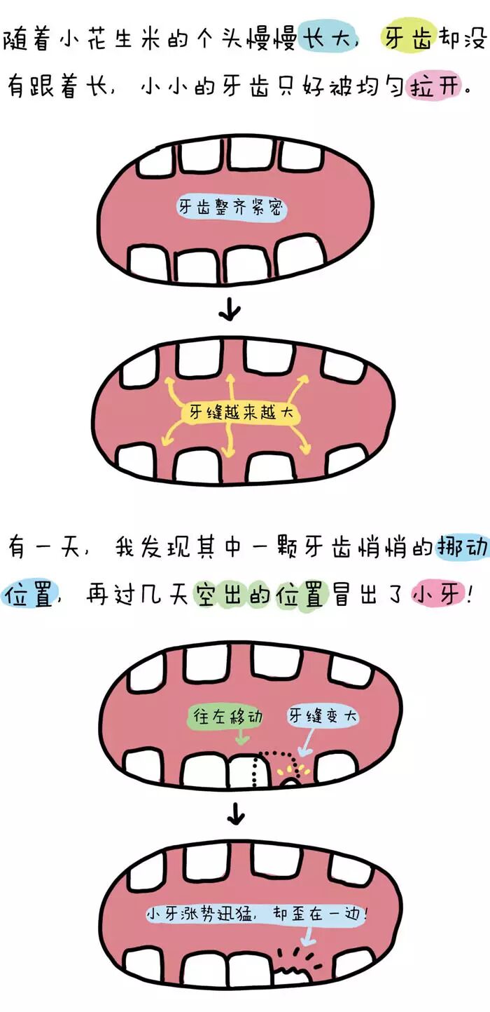 张医生告诉我:乳牙滞留原因