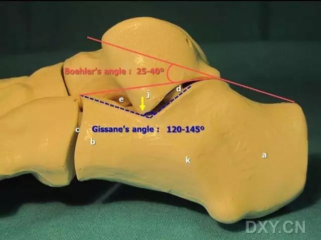 手把手教程跟骨骨折從解剖到診斷