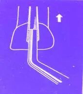 牙胶尖什么颜色​牙齿“晓”“技”｜最全根管治疗的标准步骤，以及细节把握_https://www.jmylbn.com_新闻资讯_第15张