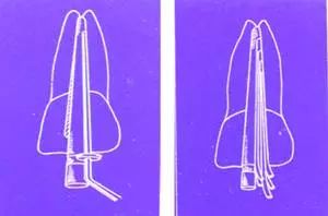 牙胶尖什么颜色【根管治疗】根管治疗的细节把握_https://www.jmylbn.com_新闻资讯_第12张