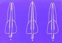 牙胶尖什么颜色​牙齿“晓”“技”｜最全根管治疗的标准步骤，以及细节把握_https://www.jmylbn.com_新闻资讯_第7张