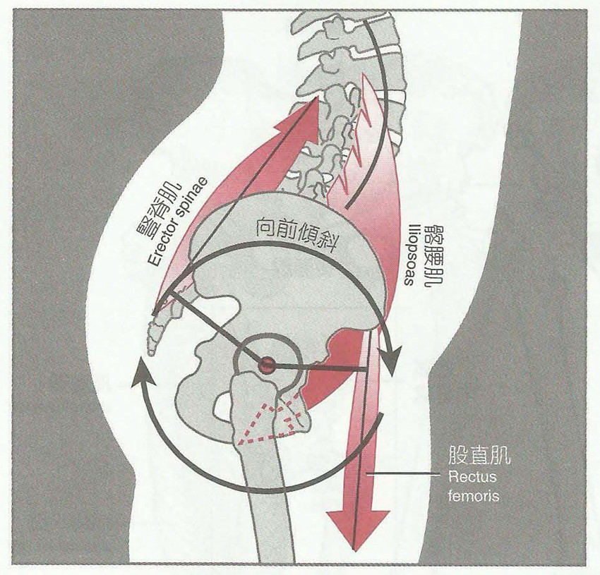 挺腹,屈髋,臀下垂—下交叉综合征的肌动学基础及处理策略