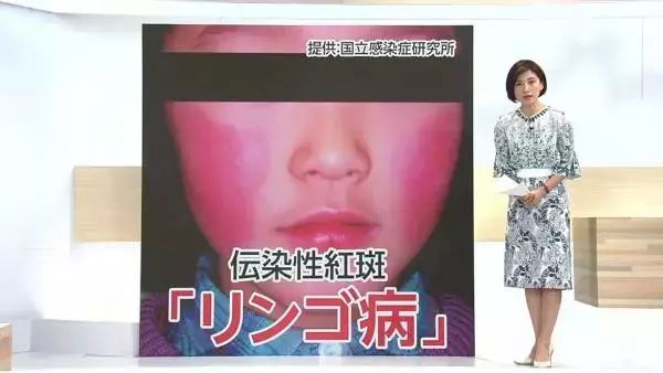注意；日本超級流感爆發，超過163w人被感染。。。 未分類 第13張
