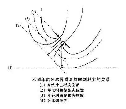 口腔H锉怎么消毒牙科医生必须看看----经典根管治疗总结_https://www.jmylbn.com_新闻资讯_第3张