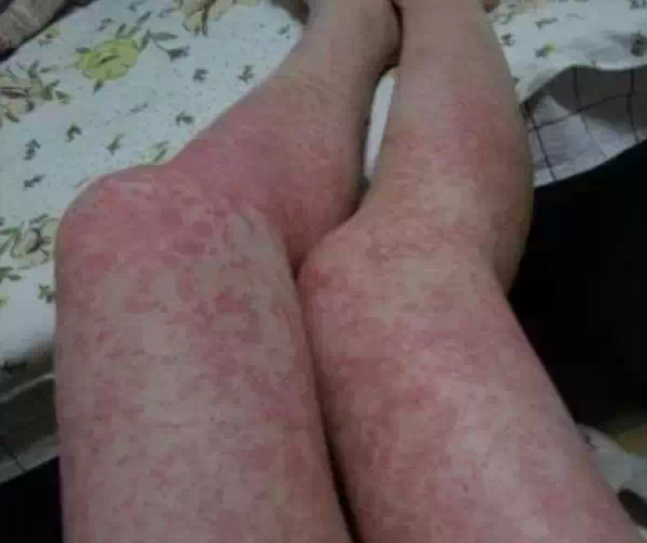 看看这个吧!否则