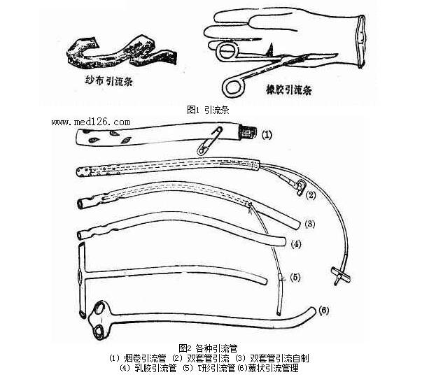 VSD怎么更换引流瓶实用引流大全，外科医生不容错过！_https://www.jmylbn.com_新闻资讯_第3张