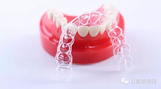 正畸颊面管是什么牙齿矫正科普帖：正畸牙套装置部件详解_https://www.jmylbn.com_新闻资讯_第14张