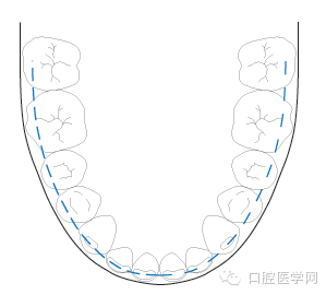 正畸颊面管是什么牙齿矫正科普帖：正畸牙套装置部件详解_https://www.jmylbn.com_新闻资讯_第18张