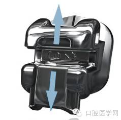 正畸颊面管是什么牙齿矫正科普帖：正畸牙套装置部件详解_https://www.jmylbn.com_新闻资讯_第7张