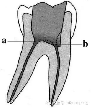口腔H锉怎么消毒根管治疗器械的选择_https://www.jmylbn.com_新闻资讯_第11张