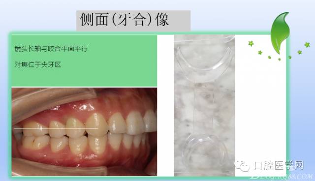 为什么口腔叫手机手机拍摄及口腔正畸摄影_https://www.jmylbn.com_新闻资讯_第14张