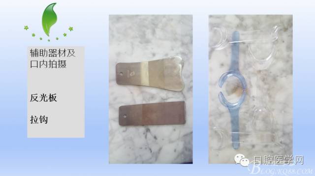 为什么口腔叫手机手机拍摄及口腔正畸摄影_https://www.jmylbn.com_新闻资讯_第9张