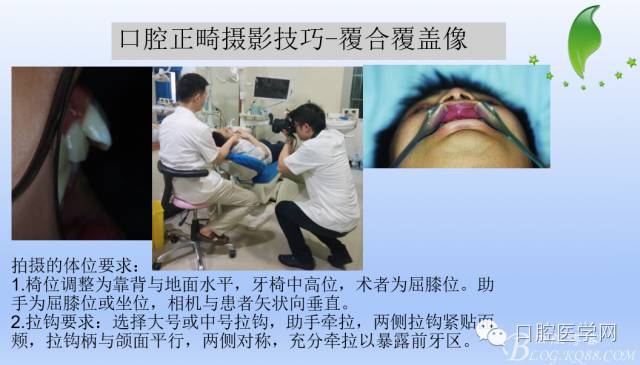 为什么口腔叫手机手机拍摄及口腔正畸摄影_https://www.jmylbn.com_新闻资讯_第16张