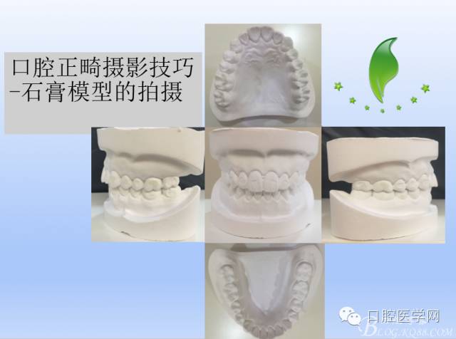 为什么口腔叫手机手机拍摄及口腔正畸摄影_https://www.jmylbn.com_新闻资讯_第18张