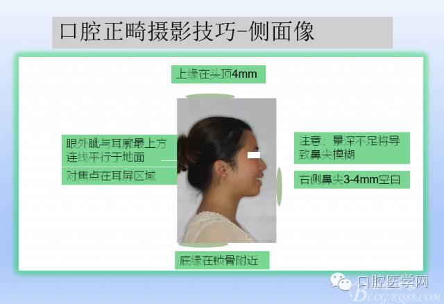 为什么口腔叫手机手机拍摄及口腔正畸摄影_https://www.jmylbn.com_新闻资讯_第11张