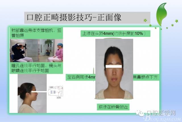 为什么口腔叫手机手机拍摄及口腔正畸摄影_https://www.jmylbn.com_新闻资讯_第10张