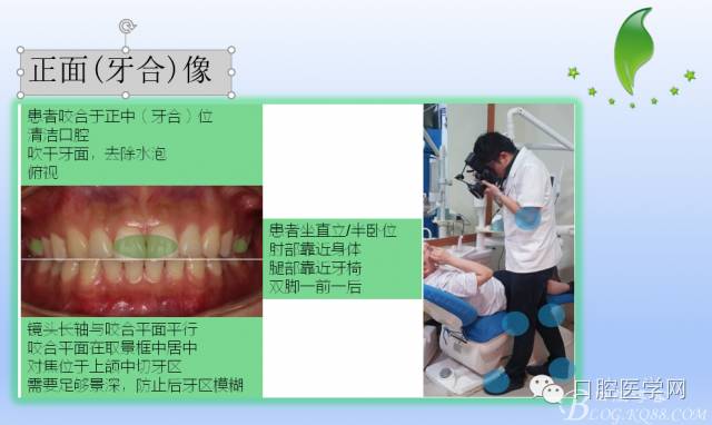 为什么口腔叫手机手机拍摄及口腔正畸摄影_https://www.jmylbn.com_新闻资讯_第13张