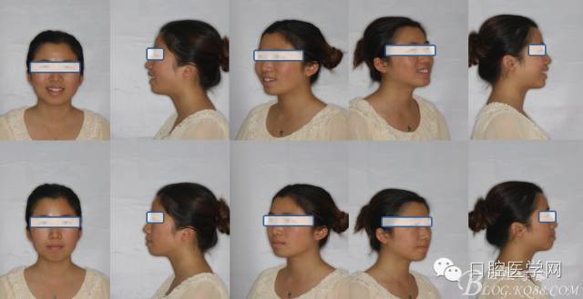 为什么口腔叫手机手机拍摄及口腔正畸摄影_https://www.jmylbn.com_新闻资讯_第12张