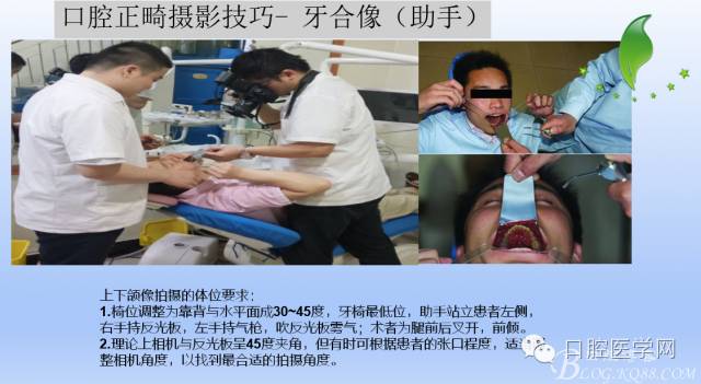 为什么口腔叫手机手机拍摄及口腔正畸摄影_https://www.jmylbn.com_新闻资讯_第15张
