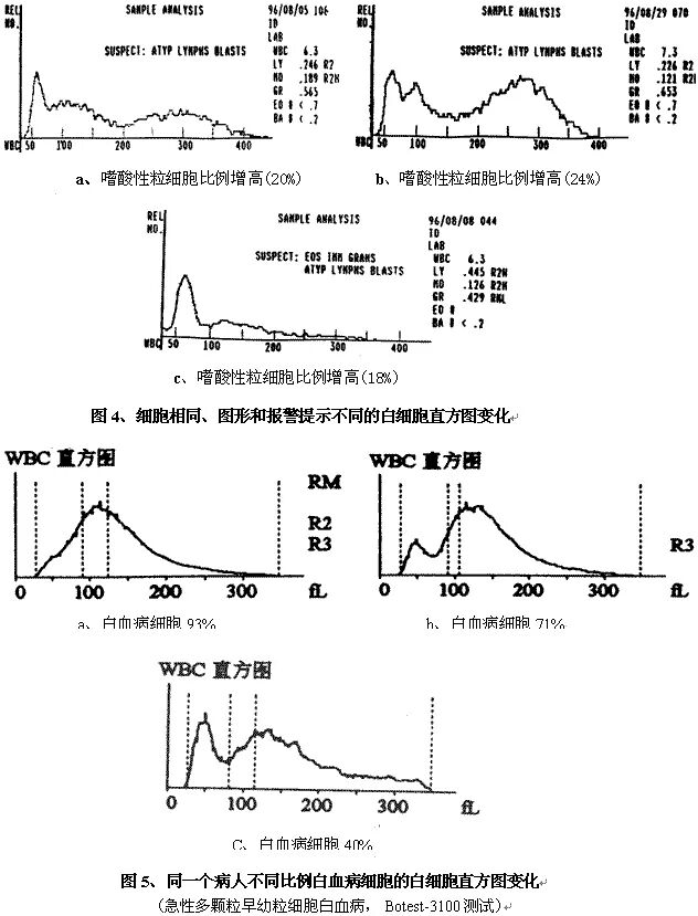 rbc直方图怎么看建议收藏 ｜ 血常规直方图特点及临床意义_https://www.jmylbn.com_新闻资讯_第8张