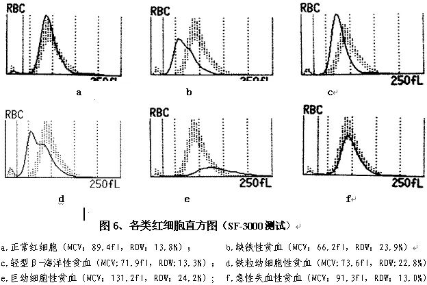 rbc直方图怎么看建议收藏 ｜ 血常规直方图特点及临床意义_https://www.jmylbn.com_新闻资讯_第9张