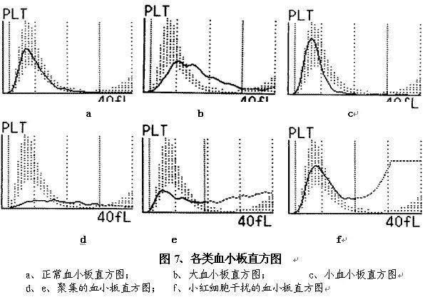 rbc直方图怎么看建议收藏 ｜ 血常规直方图特点及临床意义_https://www.jmylbn.com_新闻资讯_第10张