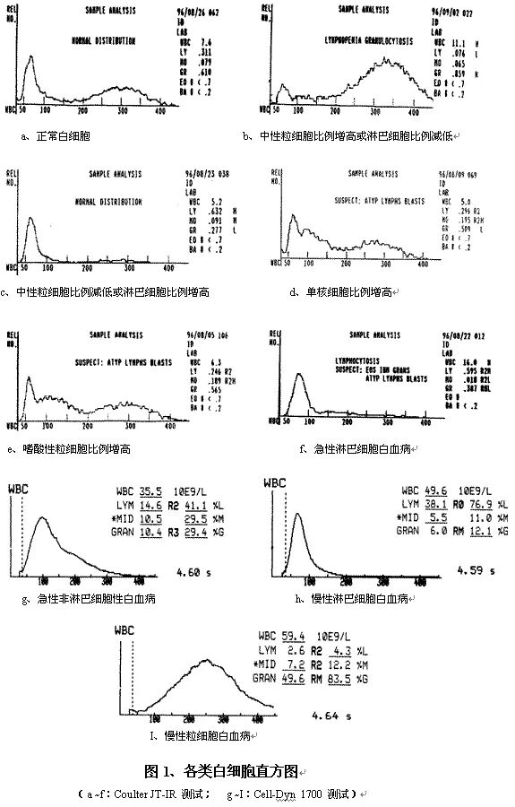 rbc直方图怎么看建议收藏 ｜ 血常规直方图特点及临床意义_https://www.jmylbn.com_新闻资讯_第5张