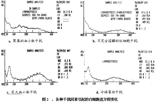 rbc直方图怎么看建议收藏 ｜ 血常规直方图特点及临床意义_https://www.jmylbn.com_新闻资讯_第6张
