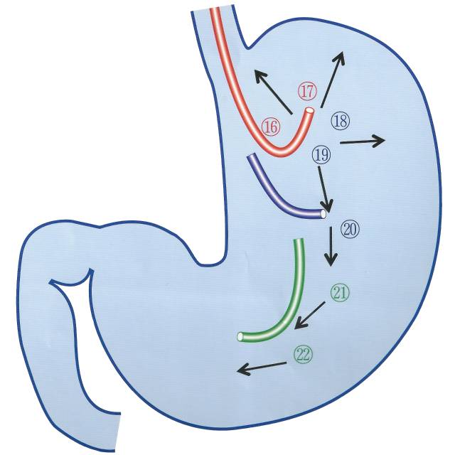 贲门大弯17-1胃穹窿后壁17-2胃穹窿前壁18-1胃穹窿大弯18-2胃体上部后
