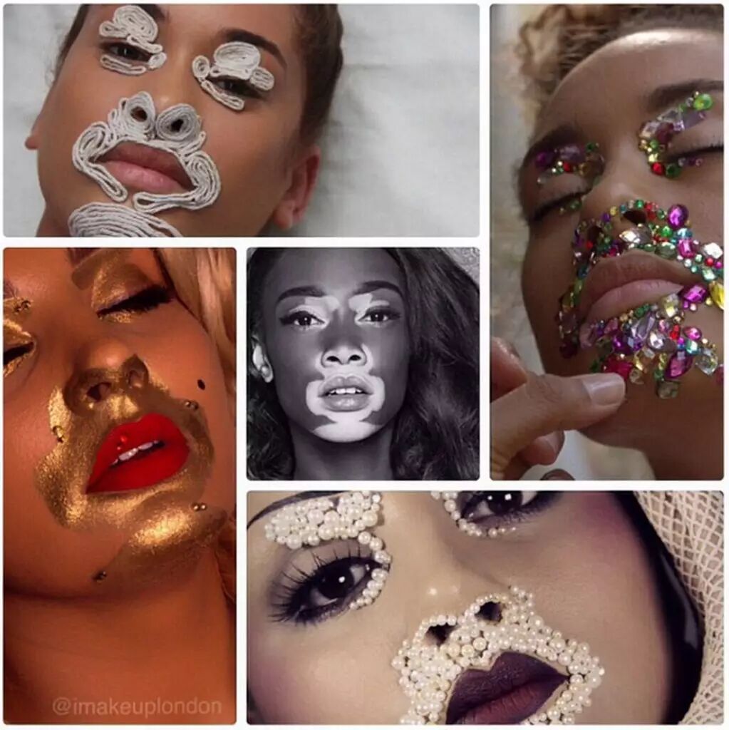 励志人物 白癜风女孩chantelle brown-young—最独特的超模