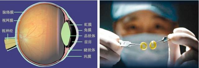 角膜就是我们俗称的"黑眼珠,位于眼球的正前方,形似圆球体的一部分.