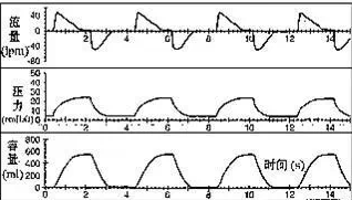 peep阀怎么使用菜鸟学呼吸机，通气模式参数设置全打包_https://www.jmylbn.com_新闻资讯_第3张