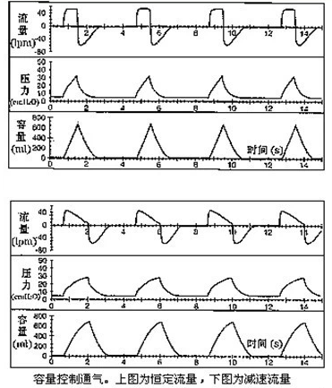 peep阀怎么使用菜鸟学呼吸机，通气模式参数设置全打包_https://www.jmylbn.com_新闻资讯_第2张