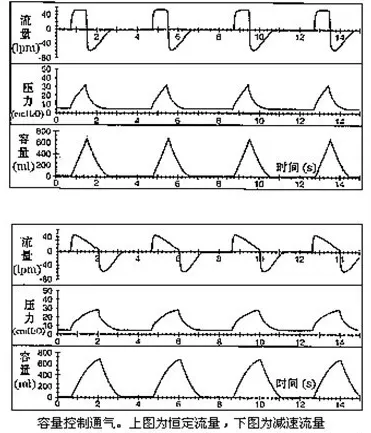 peep阀怎么使用呼吸机通气模式参数设置一篇理清！_https://www.jmylbn.com_新闻资讯_第4张