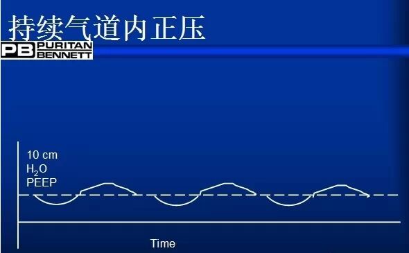 peep阀怎么使用菜鸟学呼吸机，通气模式参数设置全打包_https://www.jmylbn.com_新闻资讯_第6张