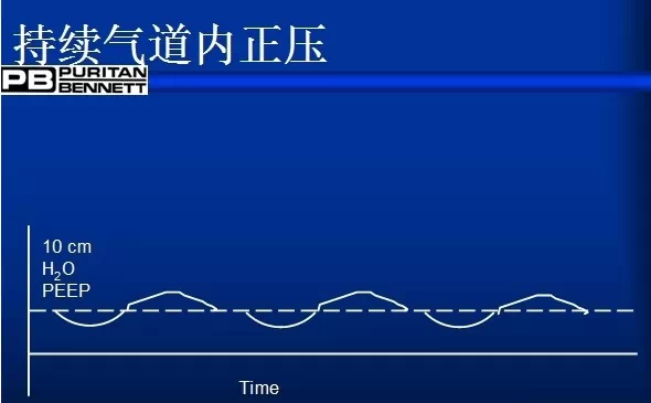peep阀怎么使用呼吸机通气模式参数设置一篇理清！_https://www.jmylbn.com_新闻资讯_第8张