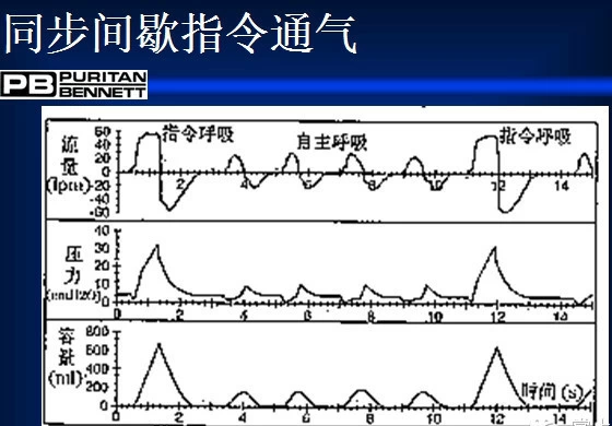 peep阀怎么使用菜鸟学呼吸机，通气模式参数设置全打包_https://www.jmylbn.com_新闻资讯_第5张