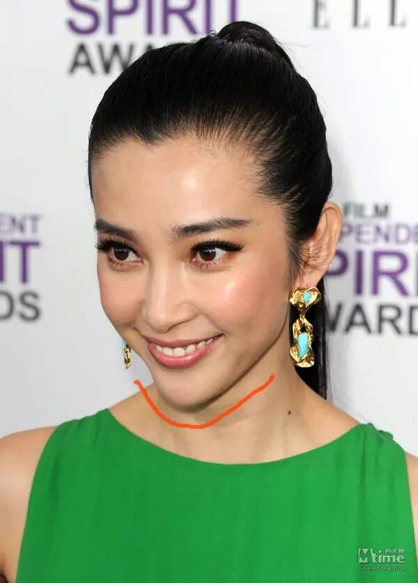 整容会被看出来吗?