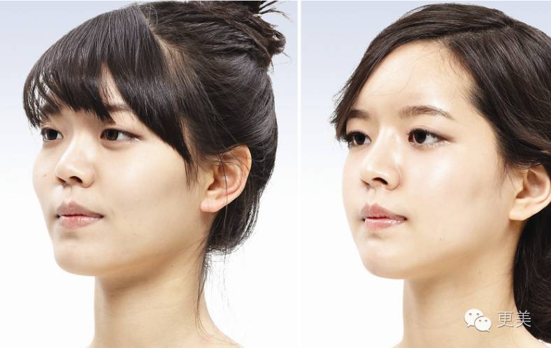 扒苏红换头史的帖子太多了这篇才是最全最强的