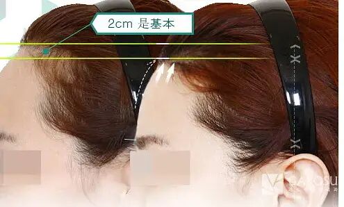 【整容】四千年美女鞠婧祎疑似连头皮都整了？！网友吐槽：是个狠人（组图） - 49