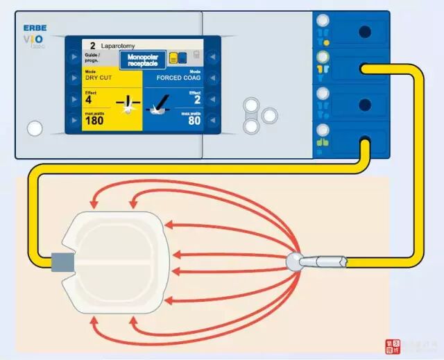 单极为什么要贴负极板【电外科】单极电刀的安全使用_https://www.jmylbn.com_新闻资讯_第3张