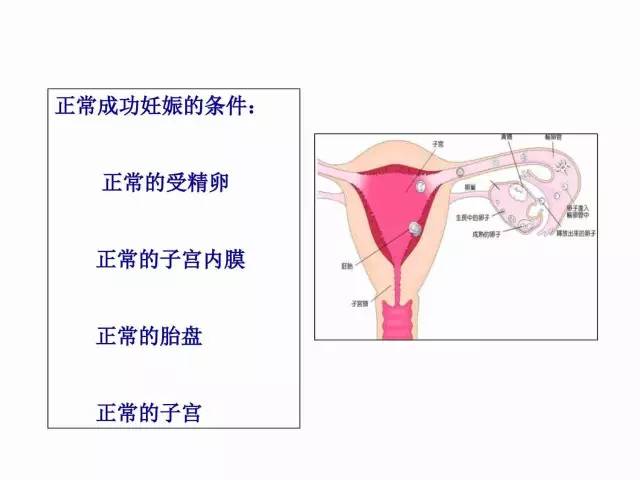 子宮瘢痕懷孕及剖腹產憩室，診斷、處理及預防 親子 第54張