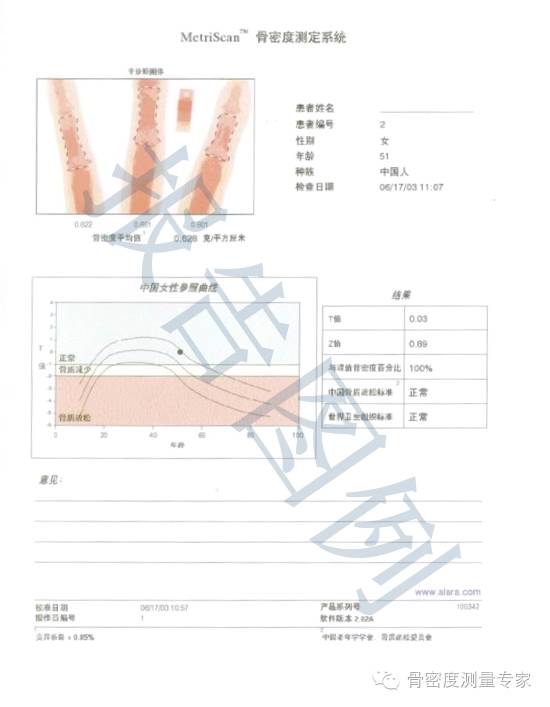骨密度bmd是什么教您如何看懂骨密度检测报告单_https://www.jmylbn.com_新闻资讯_第4张