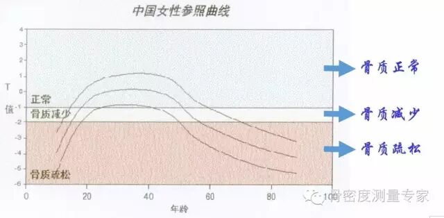 骨密度bmd是什么教您如何看懂骨密度检测报告单_https://www.jmylbn.com_新闻资讯_第2张