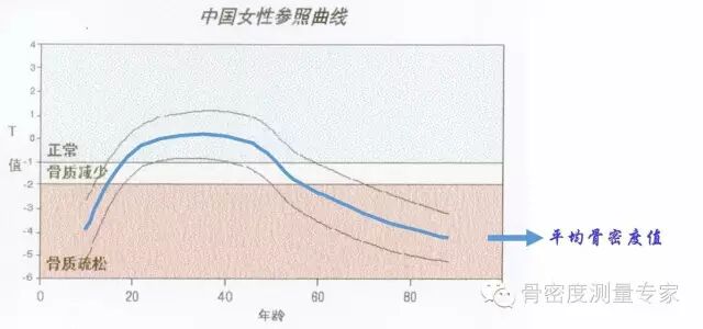 骨密度bmd是什么教您如何看懂骨密度检测报告单_https://www.jmylbn.com_新闻资讯_第3张