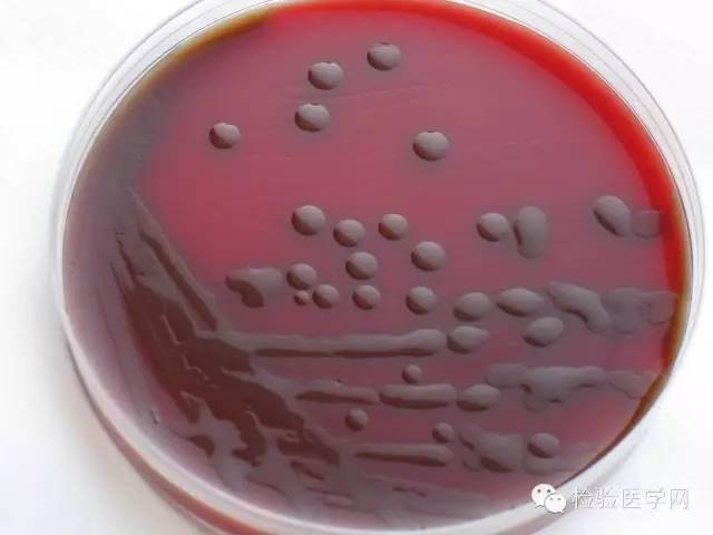 (3)肺炎链球菌的菌落形态5～10%co2,35℃培养24～48h.