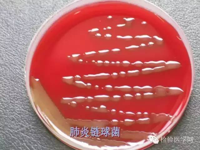 肺炎双球菌培养基图片